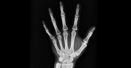 Illustration of Radiology