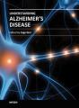 Book cover: Understanding Alzheimer's Disease