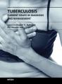 Small book cover: Tuberculosis: Current Issues in Diagnosis and Management