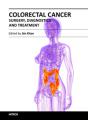 Small book cover: Colorectal Cancer: Surgery, Diagnostics and Treatment