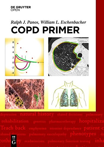 Large book cover: A COPD Primer